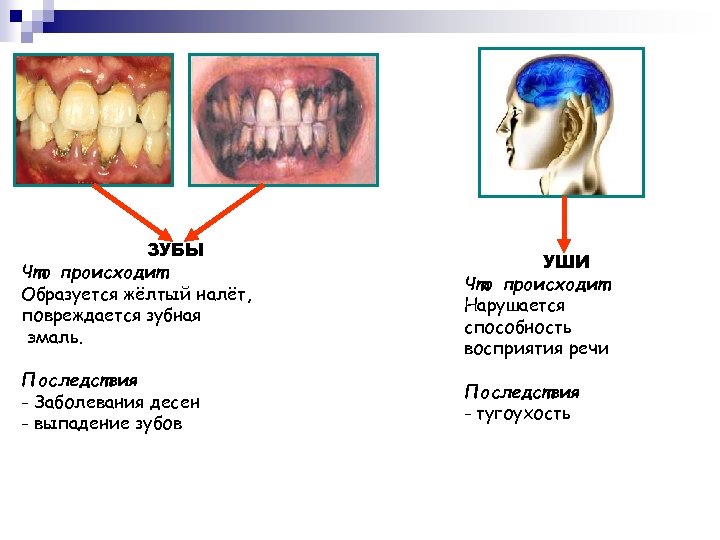 ЗУБЫ Что происходит Образуется жёлтый налёт, повреждается зубная эмаль. Последствия - Заболевания десен -