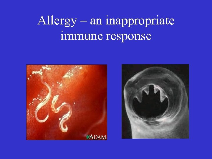 Allergy – an inappropriate immune response 