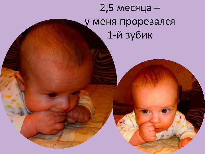2, 5 месяца – у меня прорезался 1 -й зубик 