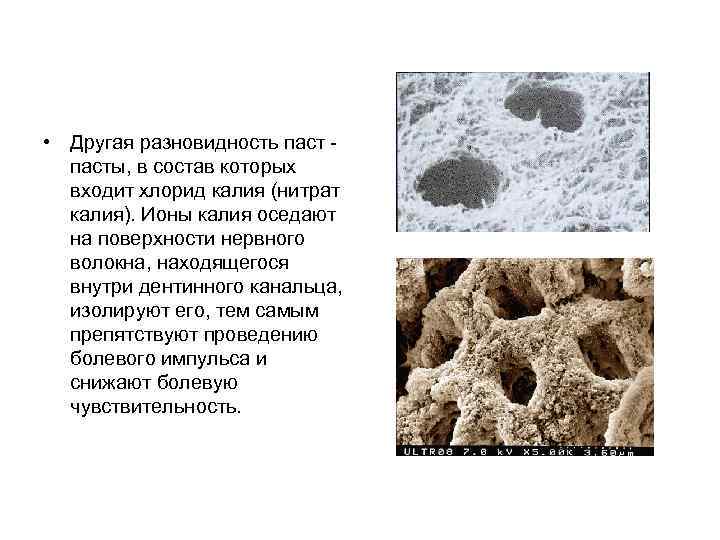  • Другая разновидность паст - пасты, в состав которых входит хлорид калия (нитрат