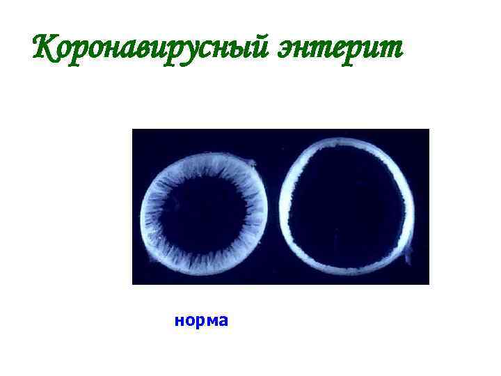 Коронавирусный энтерит норма 