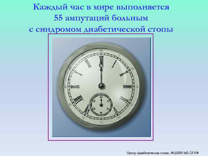 Каждый час в мире выполняется 55 ампутаций больным с синдромом диабетической стопы Центр «Диабетическая