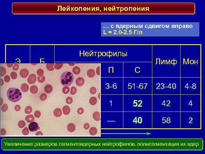 Нейтропения