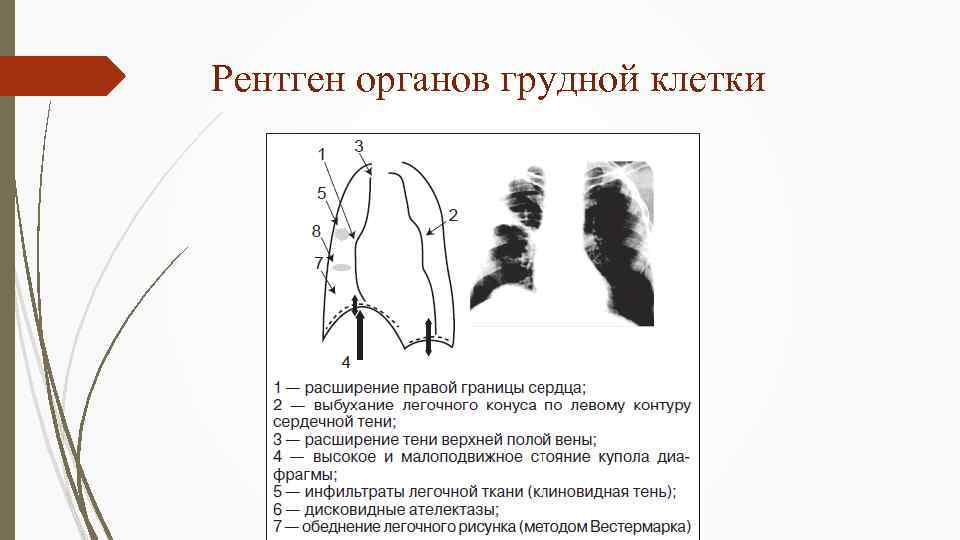 Изображение органов на рентгенограммах является ответ на тест