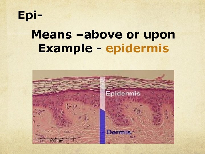 Epi. Means –above or upon Example - epidermis 