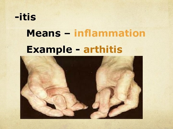 -itis Means – inflammation Example - arthitis 