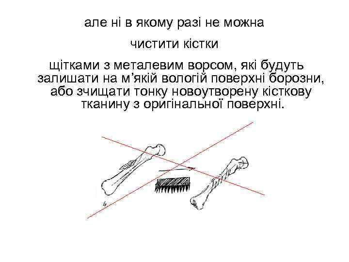 але ні в якому разі не можна чистити кістки щітками з металевим ворсом, які