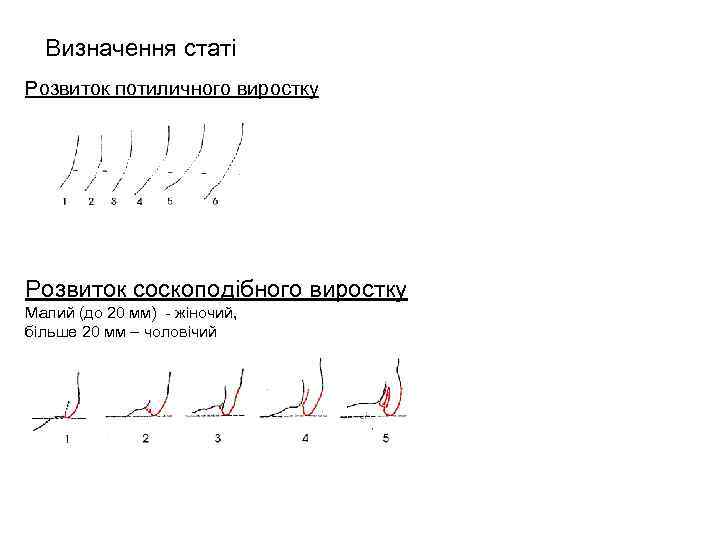 Визначення статі Розвиток потиличного виростку Розвиток соскоподібного виростку Малий (до 20 мм) - жіночий,