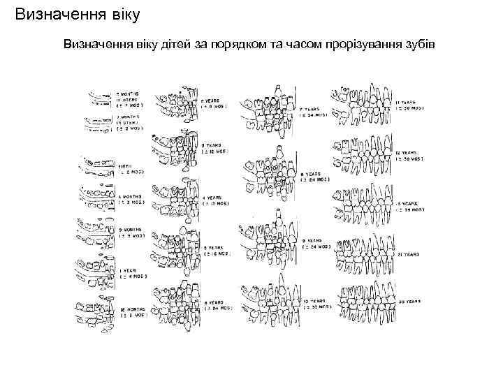 Визначення віку дітей за порядком та часом прорізування зубів 