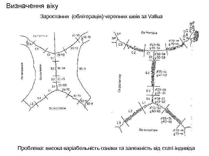 Визначення віку Заростання (облітерація) черепних швів за Vallua Проблема: висока варіабельність ознаки та залежність