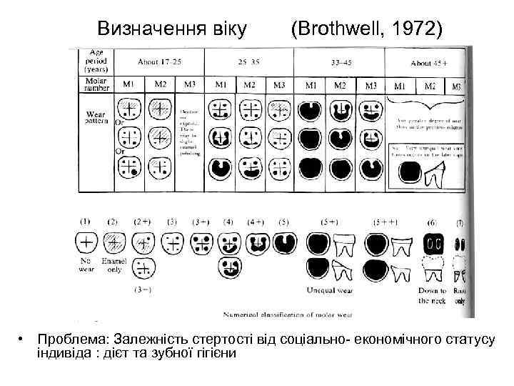 Визначення віку (Brothwell, 1972) • Проблема: Залежність стертості від соціально- економічного статусу індивіда :