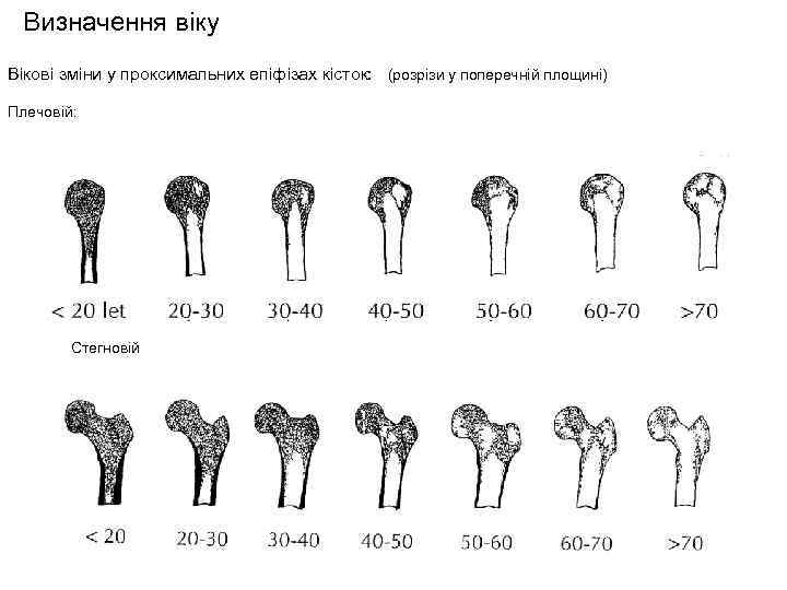 Визначення віку Вікові зміни у проксимальних епіфізах кісток: (розрізи у поперечній площині) Плечовій: Стегновій