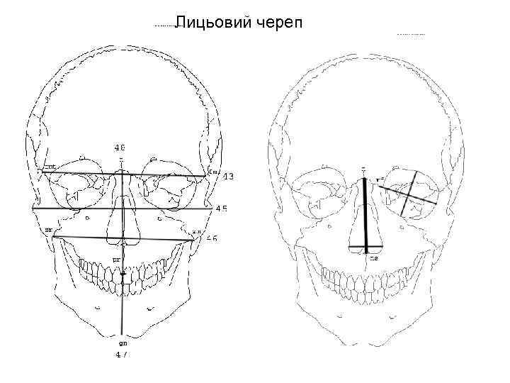 Лицьовий череп 