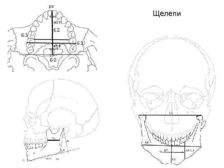 Щелепи 