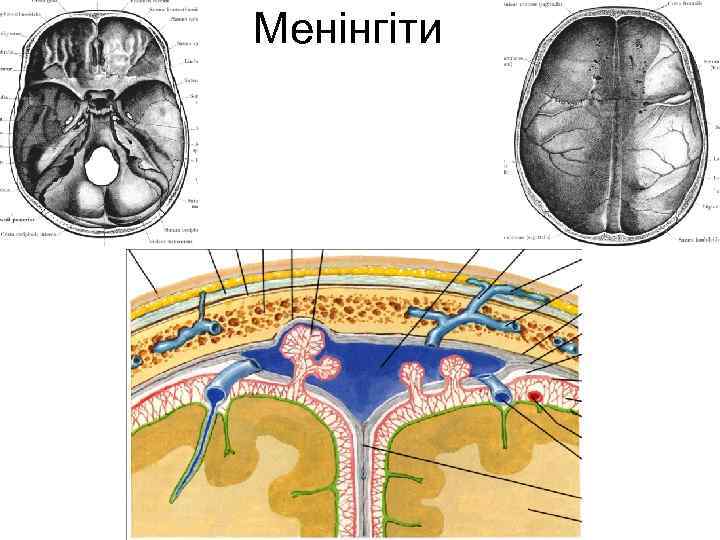 Менінгіти 