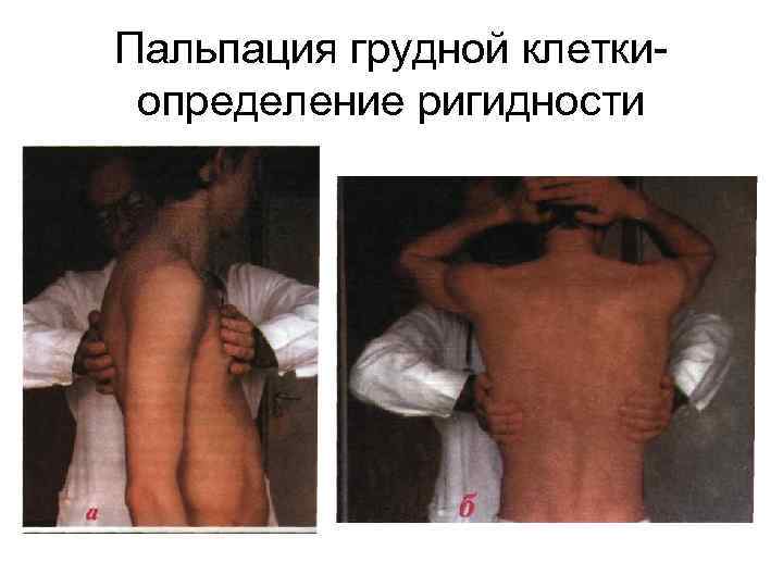 Пальпация грудной клетки определение ригидности 