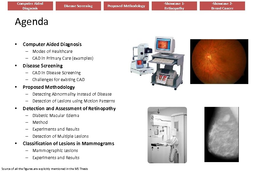 Computer Aided Diagnosis Disease Screening Proposed Methodology Agenda • Computer Aided Diagnosis – Modes