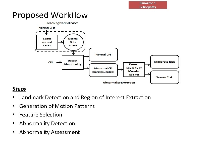 -Showcase 1 Retinopathy Proposed Workflow Steps • Landmark Detection and Region of Interest Extraction