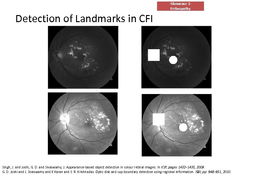 -Showcase 1 Retinopathy Detection of Landmarks in CFI Singh, J. and Joshi, G. D.