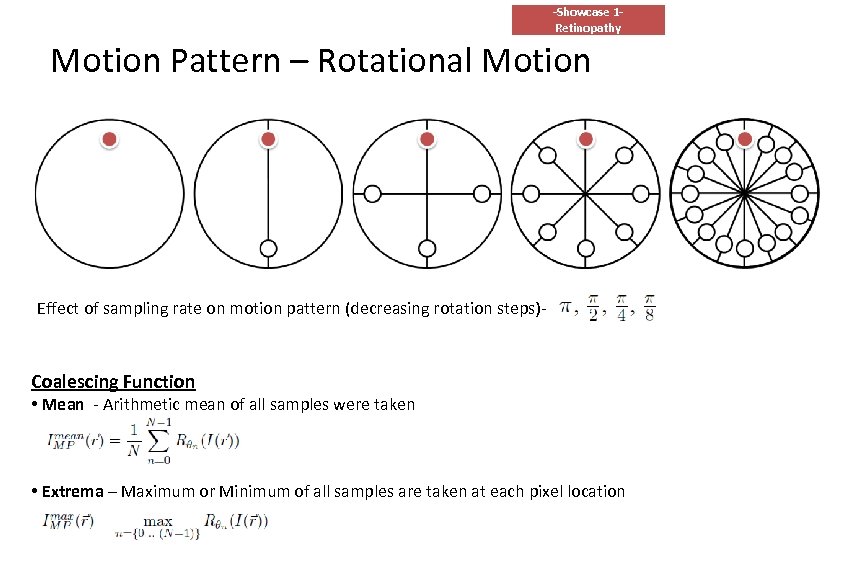 -Showcase 1 Retinopathy Motion Pattern – Rotational Motion Effect of sampling rate on motion