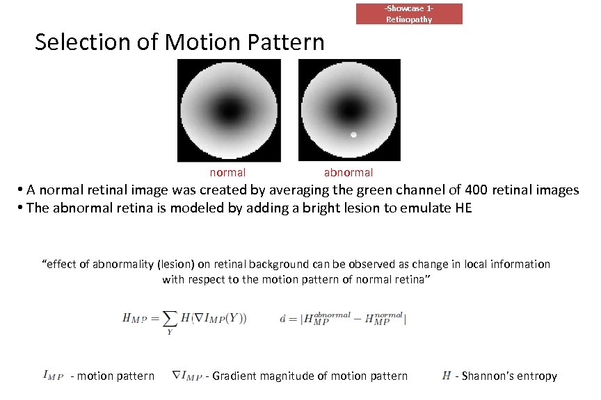 -Showcase 1 Retinopathy Selection of Motion Pattern normal abnormal • A normal retinal image