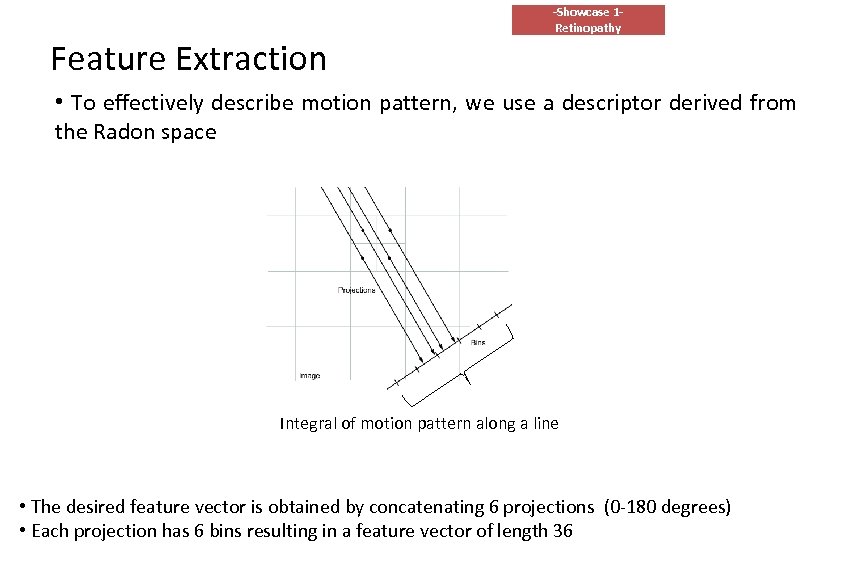 Feature Extraction -Showcase 1 Retinopathy • To effectively describe motion pattern, we use a