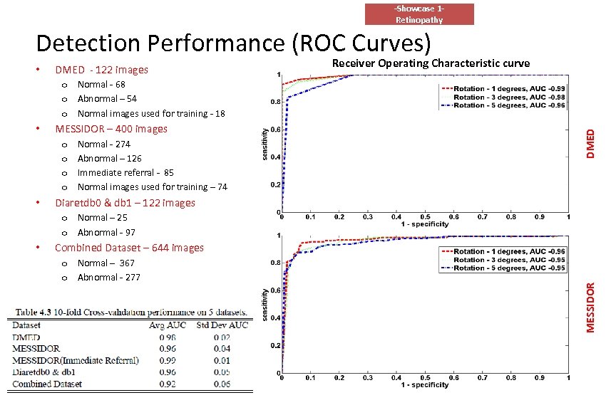 -Showcase 1 Retinopathy Detection Performance (ROC Curves) • DMED - 122 images Receiver Operating