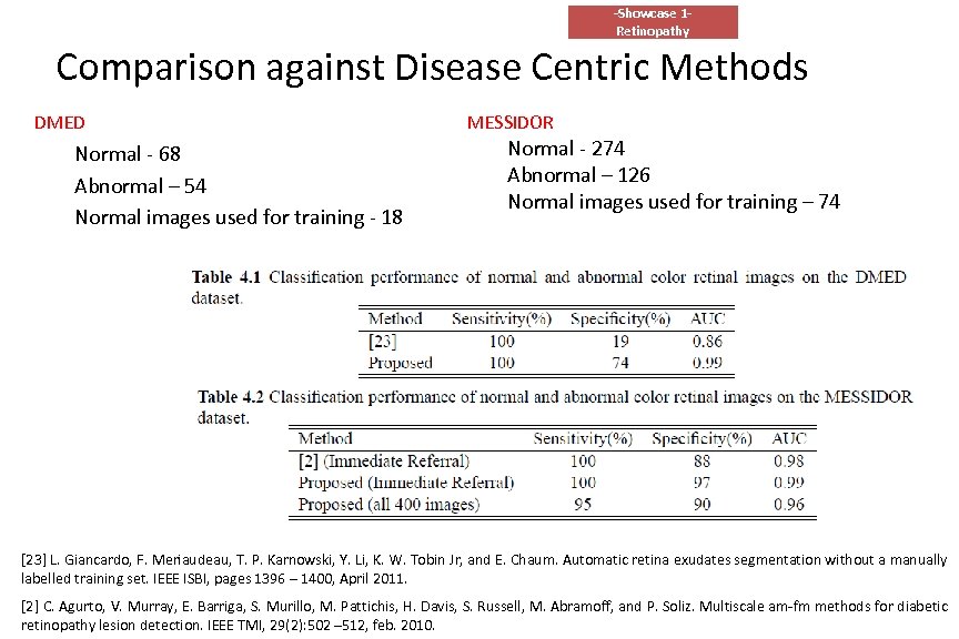 -Showcase 1 Retinopathy Comparison against Disease Centric Methods DMED Normal - 68 Abnormal –