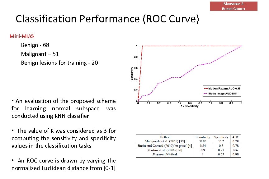 -Showcase 2 Breast Cancer Classification Performance (ROC Curve) Mini-MIAS Benign - 68 Malignant –