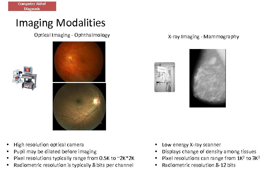 Computer Aided Diagnosis Imaging Modalities Optical Imaging - Ophthalmology • • High resolution optical