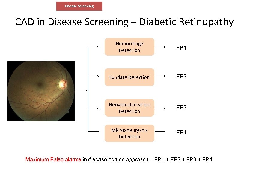 Disease Screening CAD in Disease Screening – Diabetic Retinopathy Hemorrhage Detection FP 1 Exudate