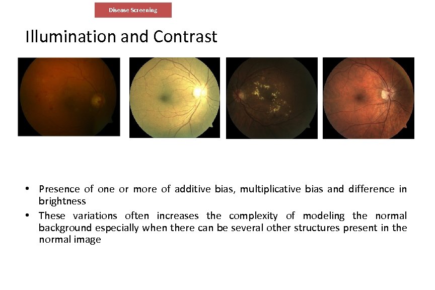 Disease Screening Illumination and Contrast • Presence of one or more of additive bias,