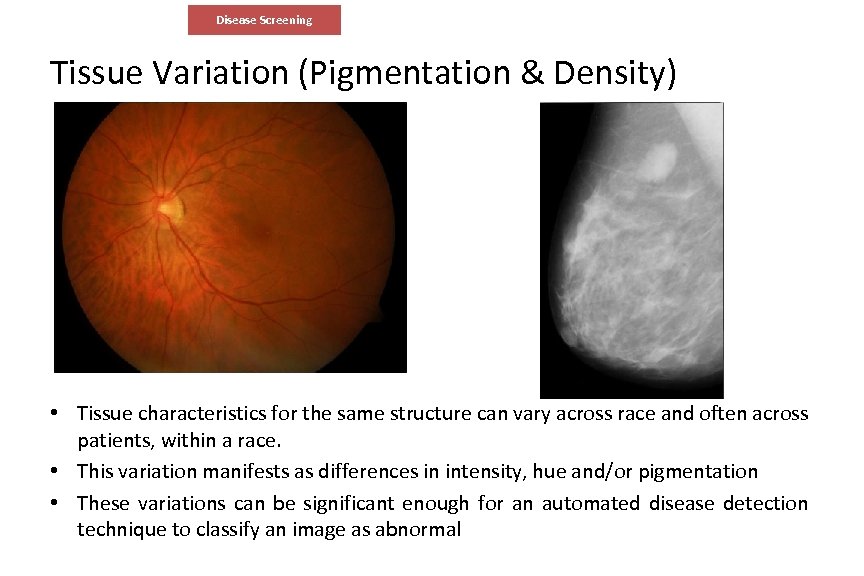 Disease Screening Tissue Variation (Pigmentation & Density) • Tissue characteristics for the same structure