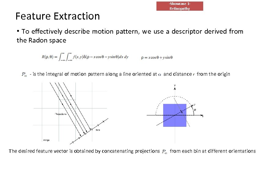 Feature Extraction -Showcase 1 Retinopathy • To effectively describe motion pattern, we use a