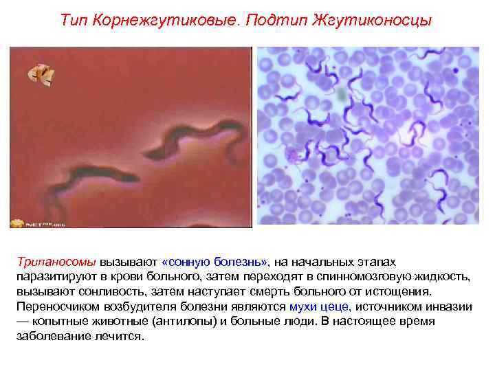 Тип Корнежгутиковые. Подтип Жгутиконосцы Трипаносомы вызывают «сонную болезнь» , на начальных этапах паразитируют в