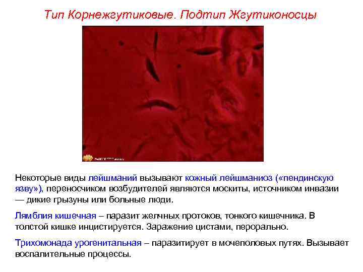 Тип Корнежгутиковые. Подтип Жгутиконосцы Некоторые виды лейшманий вызывают кожный лейшманиоз ( «пендинскую язву» ),