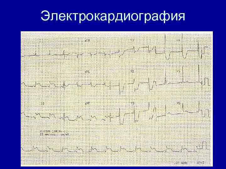 Электрокардиография 