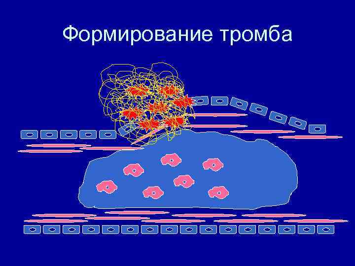 Формирование тромба 