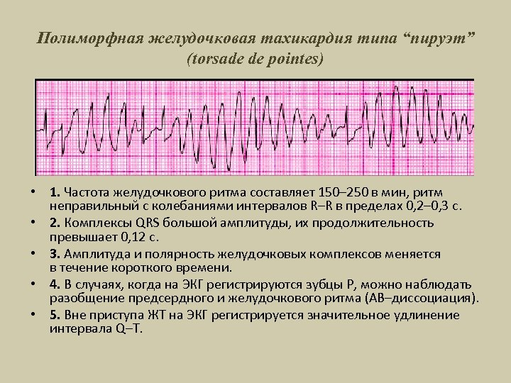 Полиморфная желудочковая тахикардия типа “пируэт” (torsade de pointes) • 1. Частота желудочкового ритма составляет