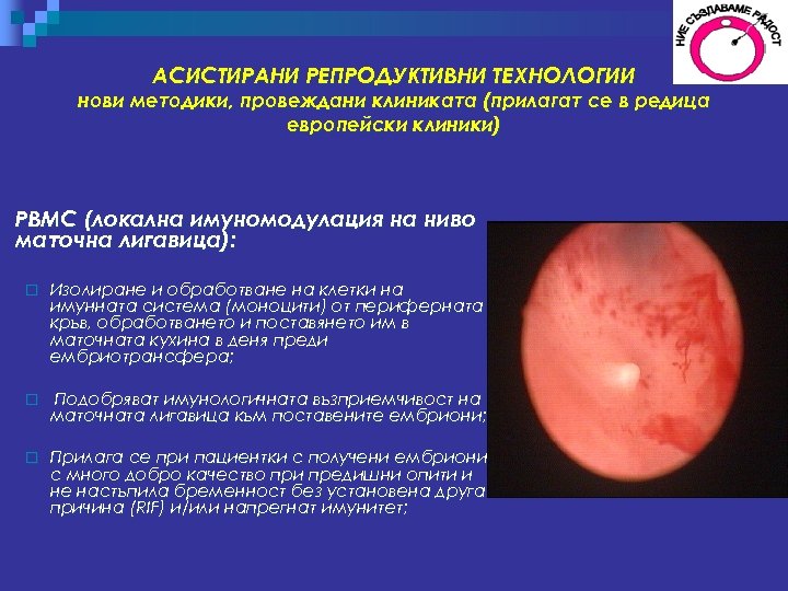 АСИСТИРАНИ РЕПРОДУКТИВНИ ТЕХНОЛОГИИ нови методики, провеждани клиниката (прилагат се в редица европейски клиники) PBMC