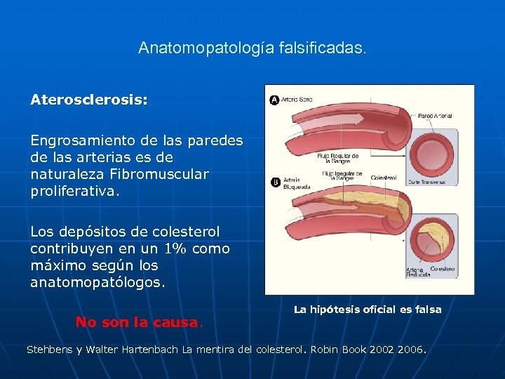 Anatomopatología falsificadas. Aterosclerosis: Engrosamiento de las paredes de las arterias es de naturaleza Fibromuscular
