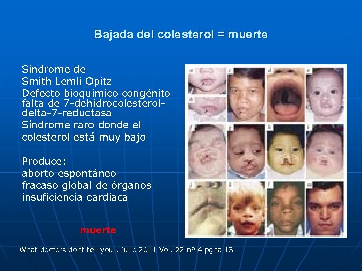 Bajada del colesterol = muerte Síndrome de Smith Lemli Opitz Defecto bioquímico congénito falta