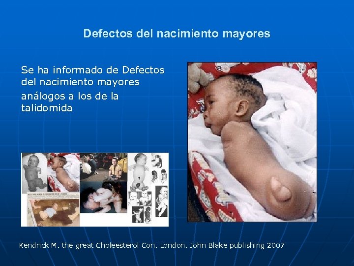 Defectos del nacimiento mayores Se ha informado de Defectos del nacimiento mayores análogos a