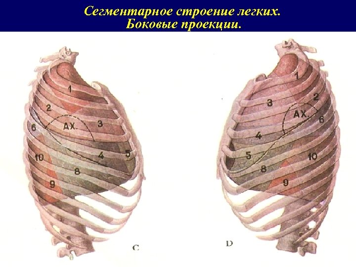 Сегментарное строение легких. Боковые проекции. 