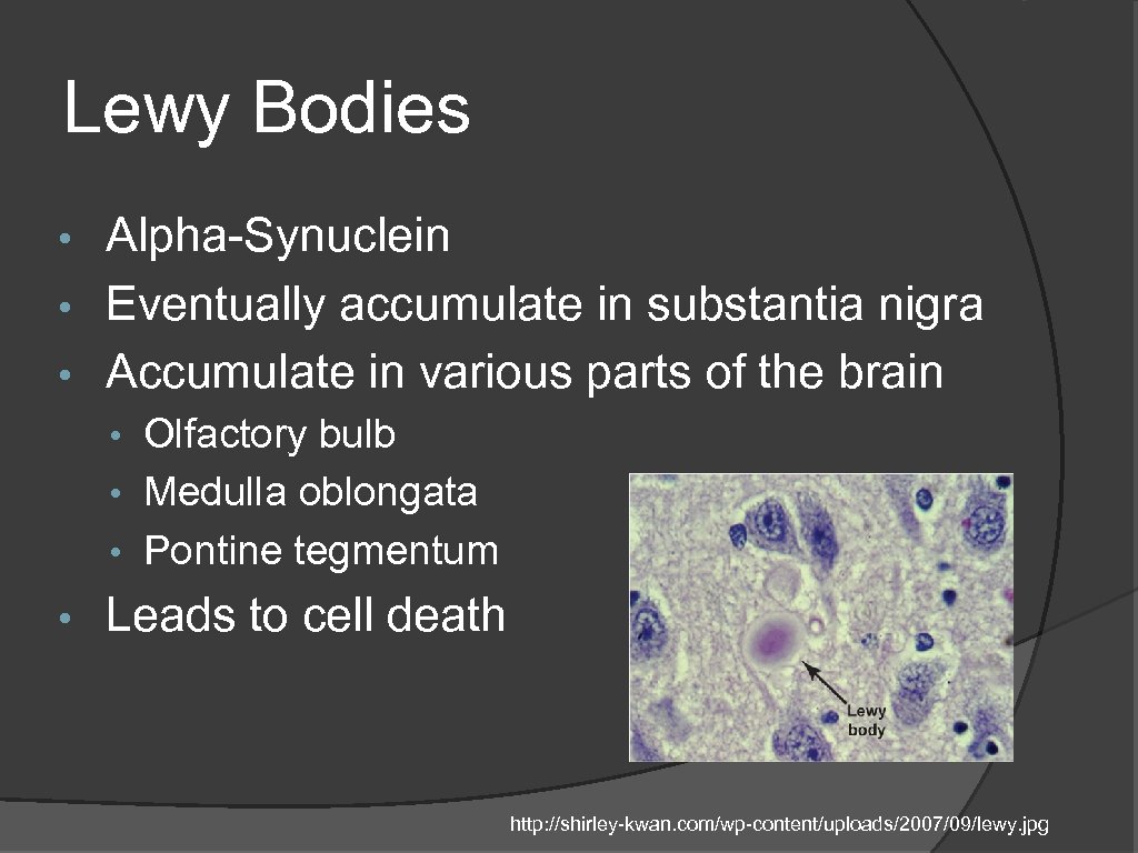 Lewy Bodies Alpha-Synuclein • Eventually accumulate in substantia nigra • Accumulate in various parts