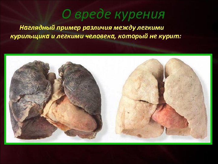 О вреде курения Наглядный пример различия между легкими курильщика и легкими человека, который не