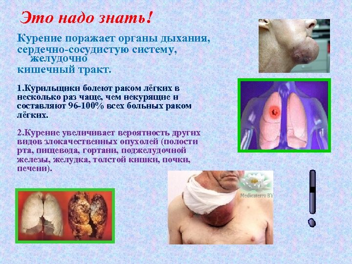 Это надо знать! Курение поражает органы дыхания, сердечно-сосудистую систему, желудочно кишечный тракт. 1. Курильщики
