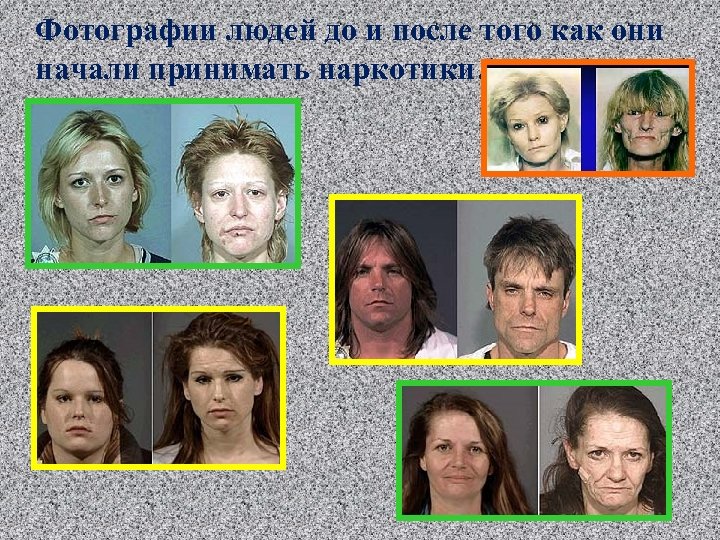 Фотографии людей до и после того как они начали принимать наркотики… 