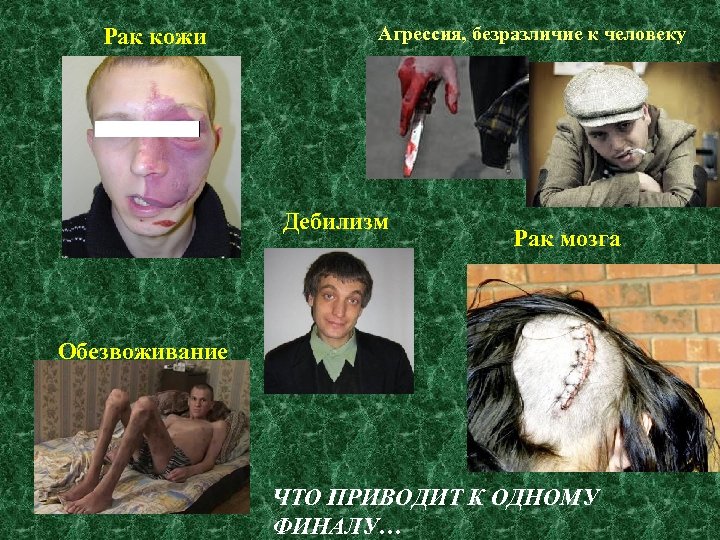 Рак кожи Агрессия, безразличие к человеку Дебилизм Рак мозга Обезвоживание ЧТО ПРИВОДИТ К ОДНОМУ