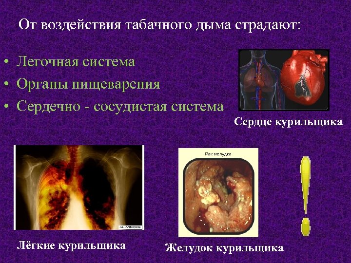 От воздействия табачного дыма страдают: • Легочная система • Органы пищеварения • Сердечно -